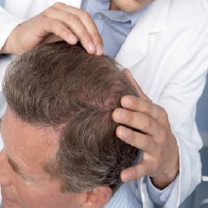 How Does Hair Restoration Work with Stem Cells?